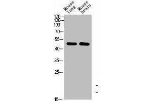 Western Blot analysis of mouse-brain mouse-lung cells using BMP-10 Polyclonal Antibody diluted at 1:1000. (BMP1 anticorps  (AA 361-410))