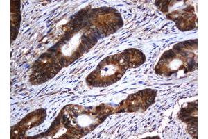 Image no. 7 for anti-SERPINE1 mRNA Binding Protein 1 (SERBP1) (AA 1-262) antibody (ABIN1490674)