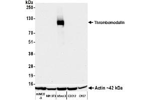 Western Blotting (WB) image for anti-Thrombomodulin (THBD) (AA 17-517) antibody (ABIN7795655)
