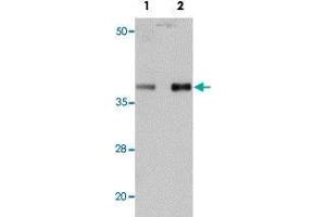 Western blot analysis of mouse heart tissue with PPAPDC3 polyclonal antibody  at (Lane 1) 1 and (Lane 2) 2 ug/mL dilution. (PPAPDC3 anticorps  (N-Term))