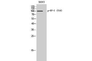 Western Blotting (WB) image for anti-Eukaryotic Translation Elongation Factor 2 (EEF2) (pThr56) antibody (ABIN3182747)