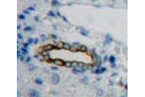 anti-Intercellular Adhesion Molecule 3 (ICAM3) (AA 259-491) antibody