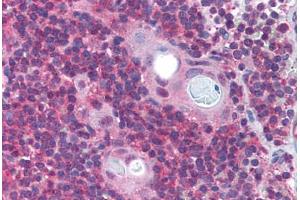 Human Thymus (formalin-fixed, paraffin-embedded) stained with PAFAH1B1 antibody ABIN213960 at 5 ug/ml followed by biotinylated goat anti-rabbit IgG secondary antibody ABIN481713, alkaline phosphatase-streptavidin and chromogen.