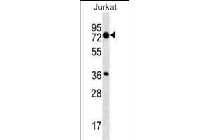 PLS1 Antibody (C-term) (ABIN657071 and ABIN2846234) western blot analysis in Jurkat cell line lysates (35 μg/lane). (PLS1 anticorps  (C-Term))