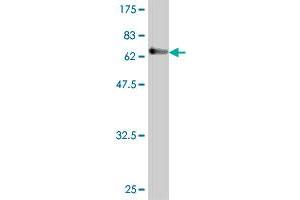 Western Blot detection against Immunogen (72.