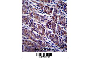 HDAC7 Antibody immunohistochemistry analysis in formalin fixed and paraffin embedded human stomach tissue followed by peroxidase conjugation of the secondary antibody and DAB staining. (HDAC7 anticorps  (C-Term))