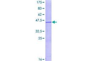 Image no. 1 for Regenerating Islet-Derived 3 alpha (REG3A) (AA 1-175) protein (GST tag) (ABIN1317769)