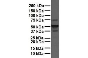 WB Suggested Anti-CSF1 antibody Titration: 1 ug/mL Sample Type: Human liver (M-CSF/CSF1 anticorps  (N-Term))