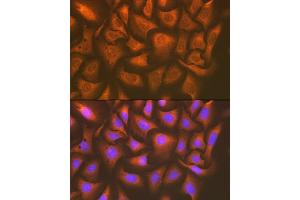 Immunofluorescence analysis of U-2 OS cells using U Rabbit mAb (ABIN7271211) at dilution of 1:100 (40x lens). (UAP1 anticorps)