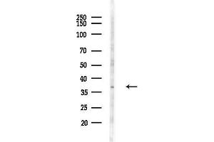 anti-Nicotinamide Nucleotide Adenylyltransferase 2 (NMNAT2) (C-Term) antibody