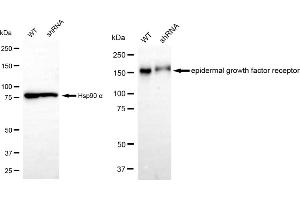 Western blotting analysis using epidermal growth factor receptor antibody (ABIN7798478).