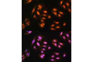 Immunofluorescence analysis of U2OS cells using  Rabbit pAb (ABIN1678593, ABIN3018971, ABIN3018972 and ABIN6220651) at dilution of 1:100. (ADRM1 anticorps  (AA 108-407))