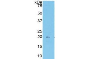 WB of Protein Standard: different control antibodies  against Highly purified E.