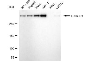 Western blotting analysis using TP53BP1 antibody (ABIN7800690). (TP53BP1 anticorps)