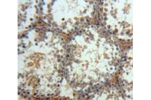 Used in DAB staining on fromalin fixed paraffin-embedded Testis tissue (MAPK10 anticorps  (AA 88-332))
