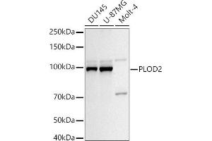 Western blot analysis of extracts of various cell lines, using PLOD2/LH2 antibody (ABIN6132888, ABIN6145788, ABIN6145790 and ABIN6222693) at 1:1000 dilution. (PLOD2 anticorps  (AA 470-650))