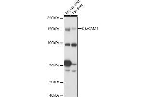 Western blot analysis of extracts of various cell lines, using CE antibody (ABIN3015546, ABIN3015547, ABIN3015548 and ABIN6218802) at 1:1000 dilution. (CEACAM1 anticorps  (AA 300-430))