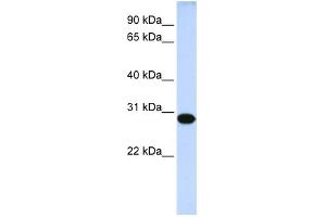 WB Suggested Anti-DRGX Antibody Titration:  0. (DRGX anticorps  (Middle Region))