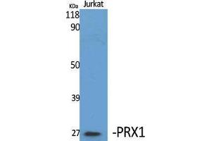 Western Blotting (WB) image for anti-Paired Related Homeobox 1 (PRRX1) (Internal Region) antibody (ABIN3186573) (PRRX1 anticorps  (Internal Region))