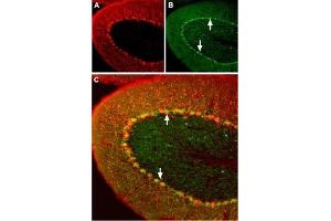 Expression of Angiotensin II Receptor Type-1 in mouse cerebellum - Immunohistochemical staining of mouse cerebellum using Anti-Angiotensin II Receptor Type-1 (extracellular) Antibody (ABIN7042922, ABIN7043900 and ABIN7043901).