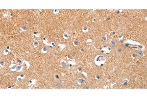 Immunohistochemistry of paraffin-embedded Human brain tissue using LRP3 Polyclonal Antibody at dilution 1:80 (LRP3 anticorps)
