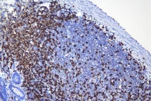 IHC analysis of CD5 using anti-CD5 antibody (ABIN7600839). (CD5 anticorps  (AA 24-494))
