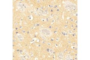 Immunohistochemistry analysis of paraffin embedded mouse brain using PPP2R2C (ABIN7075278) at dilution of 1: 500 (PPP2R2C anticorps)