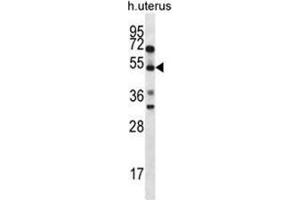 ABRA Antibody (C-term) western blot analysis in human normal Uterus cell line lysates (35ug/lane).