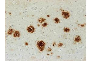 Immunostaining of paraffin embedded brain section from an Alzheimer´s patient (dilution 1 : 500). (Abeta 38/40/42 (AA 1-16), (AA 4-16) anticorps)