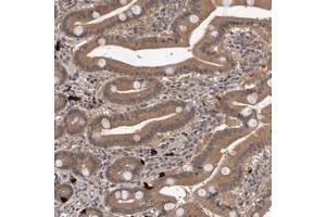Immunohistochemical staining of human duodenum with VPS37A polyclonal antibody  shows moderate cytoplasmic positivity in glandular cells at 1:200-1:500 dilution.