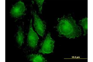 Immunofluorescence of monoclonal antibody to MAP3K7IP1 on HeLa cell.