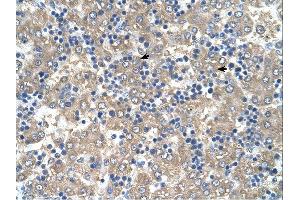 Immunohistochemistry (IHC) image for anti-BRICK1, SCAR/WAVE Actin-Nucleating Complex Subunit (BRK1) (Middle Region) antibody (ABIN2784463) (BRK1 anticorps  (Middle Region))