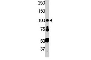 The FER polyclonal antibody  is used in Western blot to detect FER in HL-60 cell lysate. (FER anticorps  (AA 789-818))