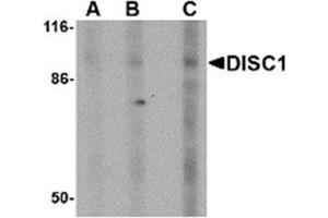 Image no. 1 for anti-Disrupted in Schizophrenia 1 (DISC1) (Middle Region) antibody (ABIN318901) (DISC1 anticorps  (Middle Region))