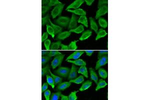 Immunofluorescence analysis of A549 cells using IFNA1 antibody (ABIN5970112). (IFNA1 anticorps)