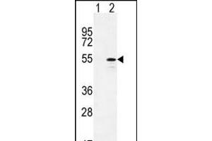 Western blot analysis of CYP26B1 (arrow) using rabbit polyclonal CYP26B1 Antibody (C-term) (ABIN392528 and ABIN2842083). (CYP26B1 anticorps  (C-Term))