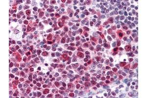 anti-High Mobility Group Box 2 (HMGB2) (AA 1-196) antibody