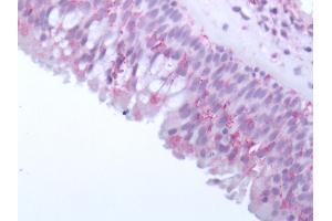 Human Olfactory Mucosa: Formalin-Fixed, Paraffin-Embedded (FFPE)