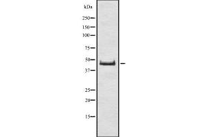 Western blot analysis of DUX4 using Jurkat whole cell lysates (DUX4 anticorps)