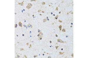 Immunohistochemistry of paraffin-embedded rat brain using PDP1 antibody (ABIN6132860, ABIN6145404, ABIN6145405 and ABIN6221944) at dilution of 1:100 (40x lens).