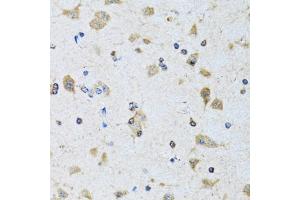 Immunohistochemistry of paraffin-embedded rat brain using PDP1 antibody (ABIN6132860, ABIN6145404, ABIN6145405 and ABIN6221944) at dilution of 1:100 (40x lens). (PDP anticorps  (AA 278-537))
