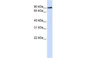 DCLRE1C antibody used at 1 ug/ml to detect target protein. (DCLRE1C anticorps)