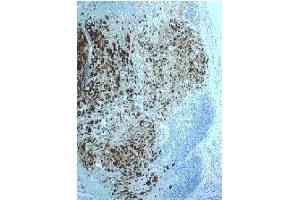 Immunohistochemistry (IHC) image for anti-Secretoglobin, Family 2A, Member 2 (SCGB2A2) antibody (ABIN452654) (Mammaglobin A anticorps)