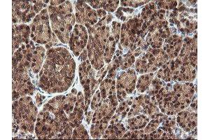 Image no. 4 for anti-Proline Synthetase Co-Transcribed (PROSC) antibody (ABIN1500439)