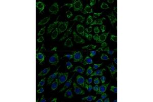 Immunofluorescence analysis of L929 cells using IDH3B Polyclonal Antibody (ABIN6128145, ABIN6142149, ABIN6142150 and ABIN6217848) at dilution of 1:100 (40x lens). (IDH3B anticorps  (AA 35-170))