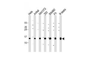 All lanes : Anti-UBE2D2 Antibody (N-term) at 1:2000 dilution Lane 1: Hela whole cell lysate Lane 2: Jurkat whole cell lysate Lane 3: NIH/3T3 whole cell lysate Lane 4: 293 whole cell lysate Lane 5: S whole cell lysate Lane 6: F9 whole cell lysate Lane 7: rat testis lysate Lysates/proteins at 20 μg per lane. (UBE2D2 anticorps  (N-Term))