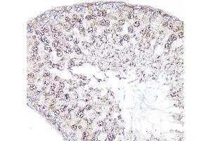 Immunohistochemistry of paraffin-embedded rat testis using PEG10 Rabbit pAb (ABIN3016692, ABIN3016693, ABIN1681320 and ABIN6219814) at dilution of 1:100 (40x lens).