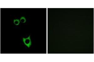 Immunofluorescence analysis of MCF7 cells, using VIPR2 Antibody. (VIPR2 anticorps)