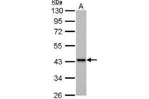 WB Image IVD antibody detects IVD protein by Western blot analysis. (IVD anticorps)