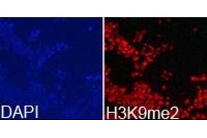Immunofluorescence analysis of 293T cell using H3K9me2 antibody. (Histone anticorps)